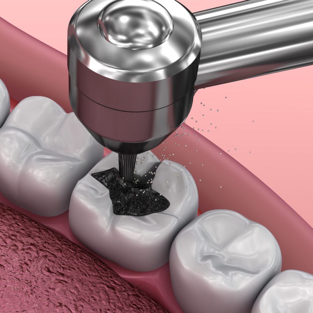 endodonzia e conservativa
