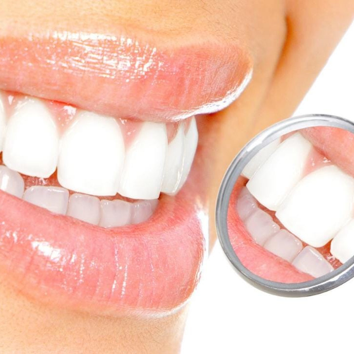 parodontologia benefici